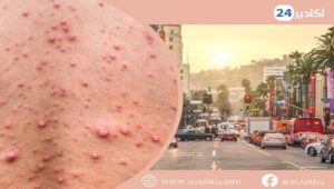 أمريكا : إعلان حالة الطوارئ في ولاية كاليفورنيا بعد المرض السريع الإنتشار. 2 أمريكا0308