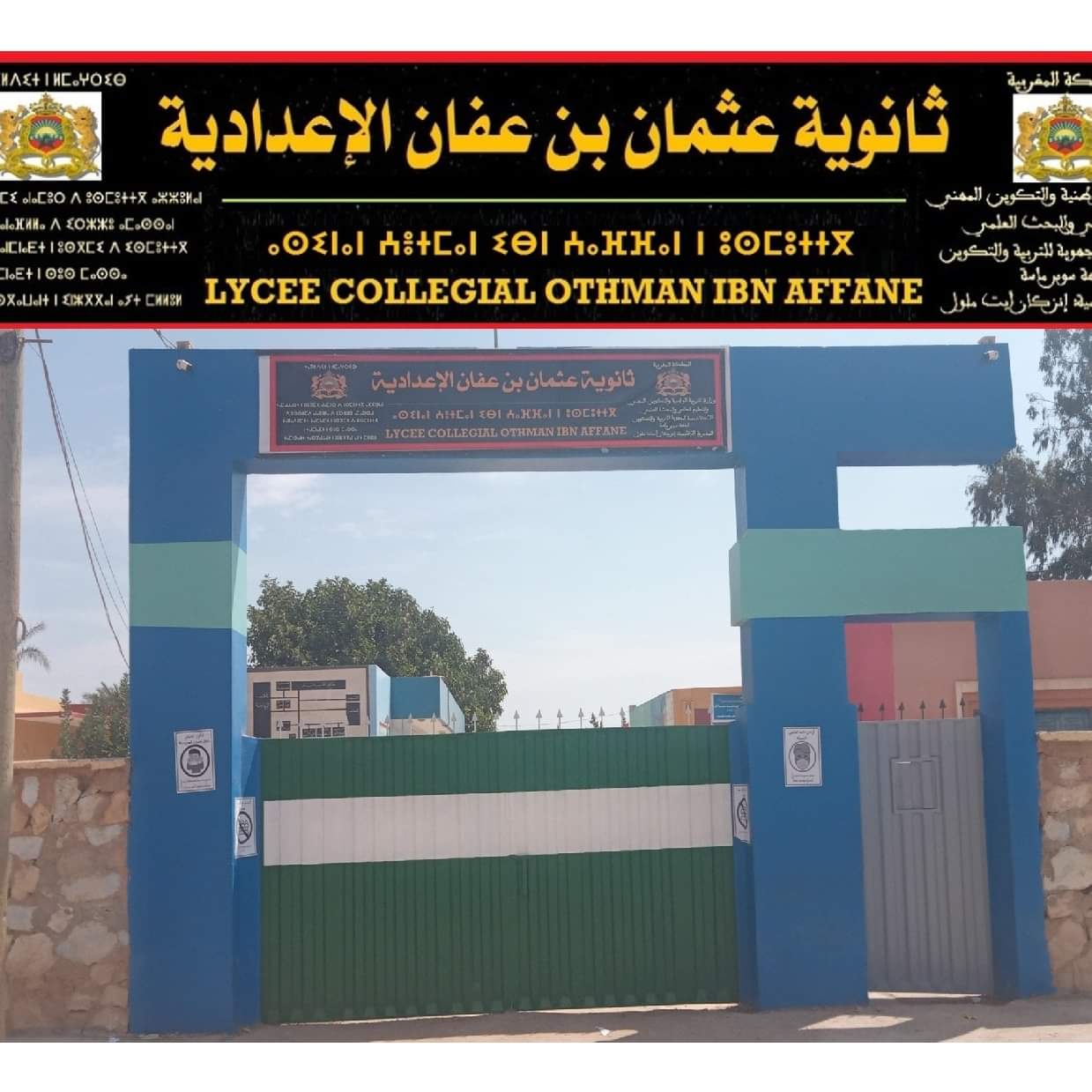 إنزكان : تلميذ يتلقى طعنة سكين في وجهه أمام إعدادية.