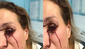 أكادير : ذو سوابق “يشرمل” فتاة و يرسلها في حالة حرجة إلى المستعجلات لحظات قبل الإفطار.