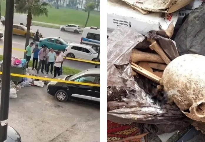 عظام وجمجمة بشرية