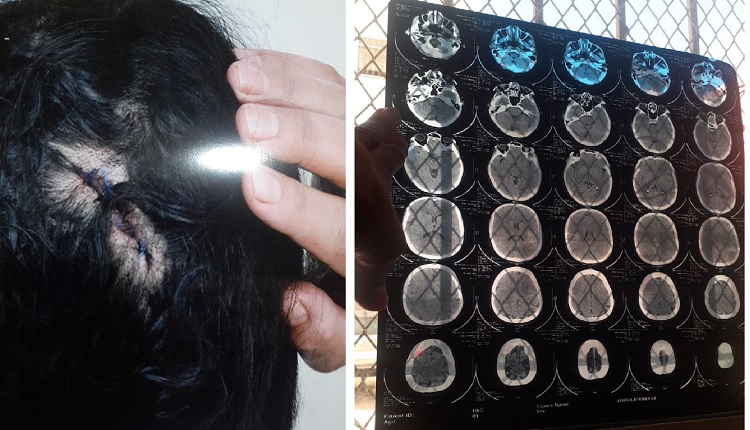 حادثة إعتداء إنزكان