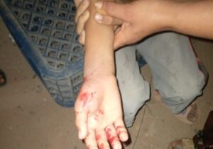 أكادير : طفل ينجو من الموت تحت عجلات شاحنة لجمع النفايات بأورير. (+صورة)