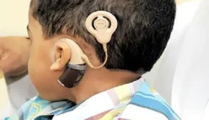 مطالب بالنظر في معاناة فاقدي السمع مع التكاليف الباهظة لعمليات زرع القوقعة السمعية وتجديد المعالج الصوتي