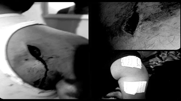 اعتداء ليلي في إنزكان ينتهي بتوقيف مشتبه فيهم