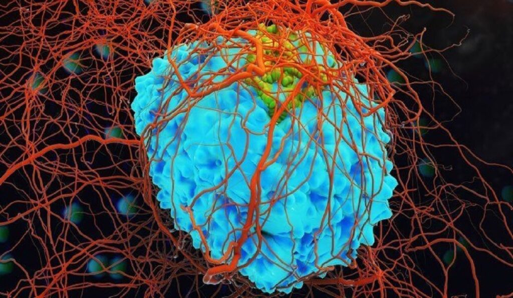 علماء روس يطوّرون مركبات نحاسية تستهدف الحمض النووي للخلايا السرطانية