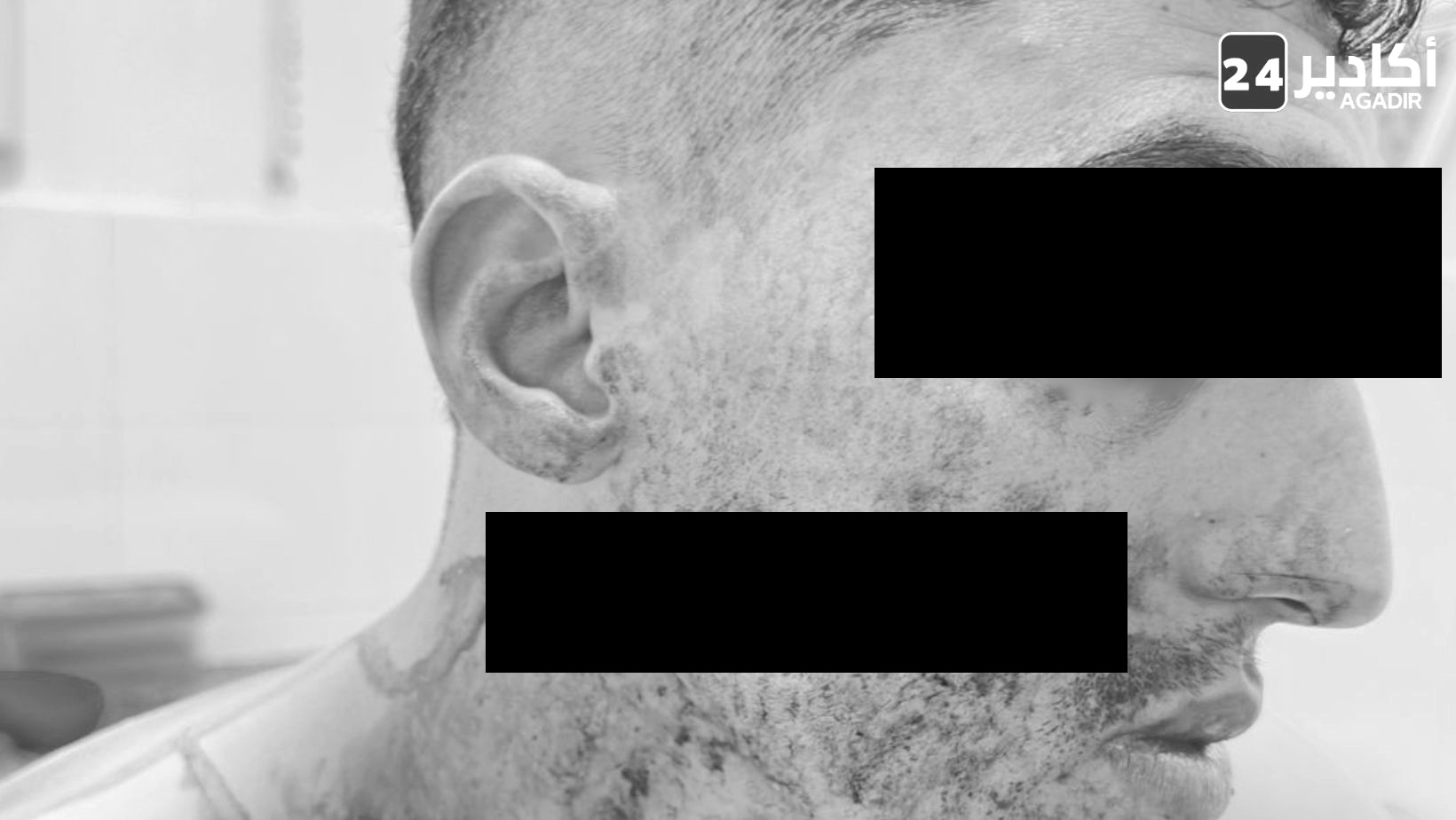 بعد اعتداء مروع ب:”تغازوت”.. القضاء يحجز ملف “مشرمل” ذا سوابق للنطق بالحكم يوم الأربعاء بعد اعتداء مروع ب:”تغازوت”.. القضاء يحجز ملف “مشرمل” ذا سوابق للنطق بالحكم يوم الأربعاء