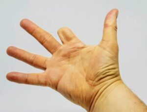 شرطة أسفي تفك لغز “فيديو بتر اليد” وتطيح بالمتورطين في جريمة العاهة المستديمة