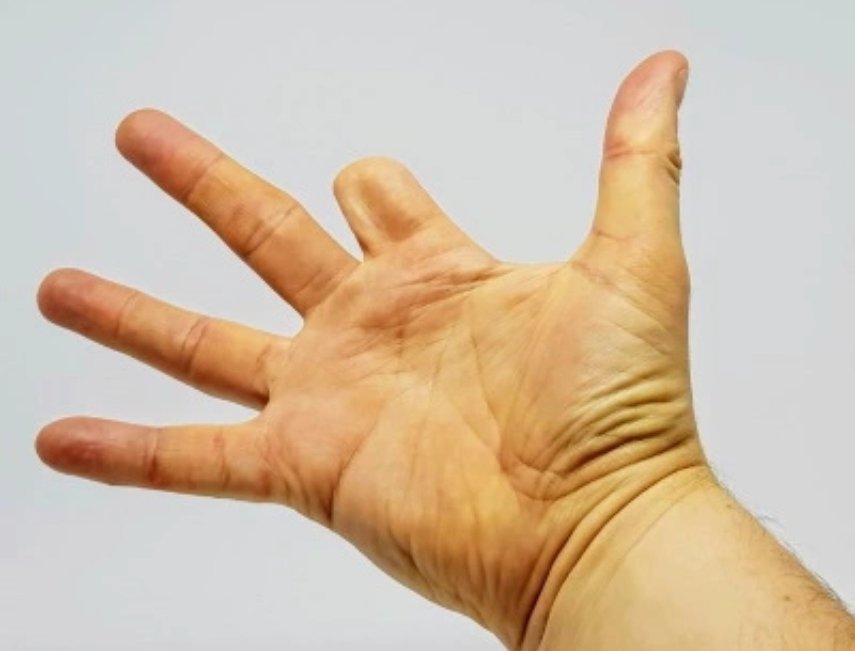 شرطة أسفي تفك لغز “فيديو بتر اليد” وتطيح بالمتورطين في جريمة العاهة المستديمة