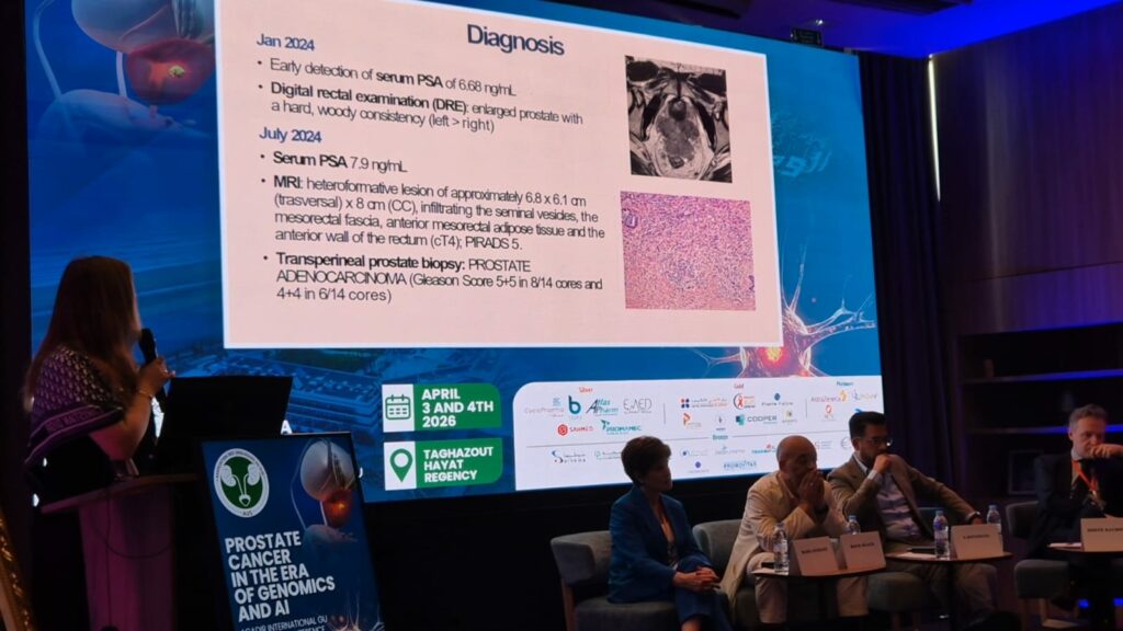 أكادير تحتضن مؤتمر AUS.. ثورة الجينوم والذكاء الاصطناعي تغيّر علاج سرطان البروستاتا بالمغرب (+ فيديو وصور) أكادير تحتضن مؤتمر AUS.. ثورة الجينوم والذكاء الاصطناعي تغيّر علاج سرطان البروستاتا بالمغرب (+ فيديو وصور)